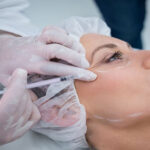 Botox-Fillers (1)