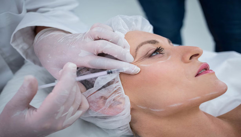 Botox-Fillers (1)