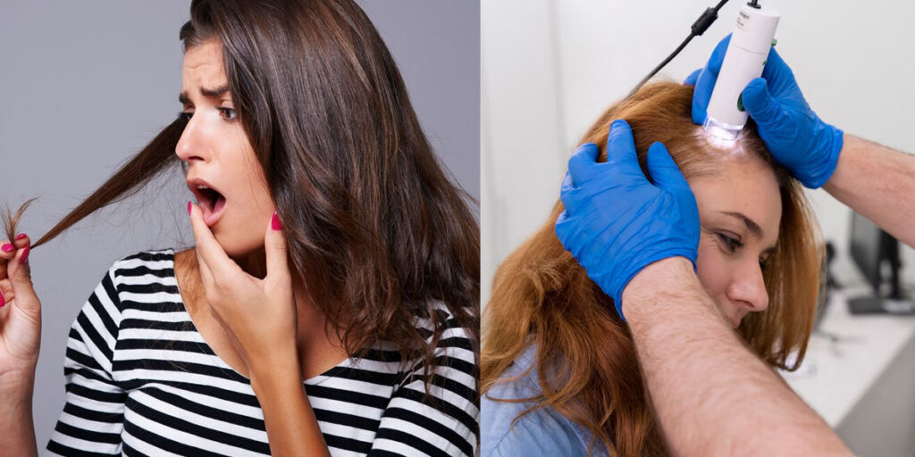 hair thinning