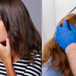 hair thinning