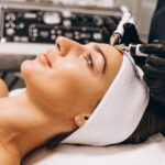 Potenza RF Microneedling