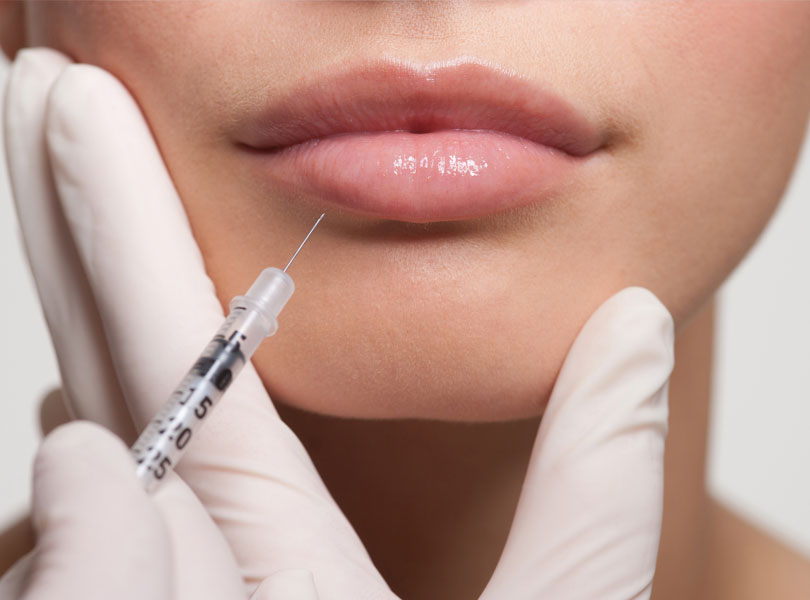 Dermal Fillers