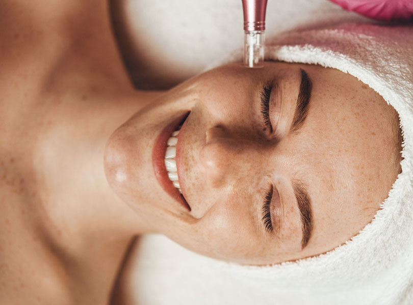 Potenza RF Microneedling